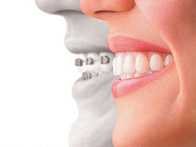 Zen Dentistry | Oral Cancer Screening, Dental Cleanings and Teeth Whitening