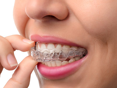Zen Dentistry | Periodontal Treatment, Sports Mouthguards and Implant Dentistry